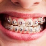 orthodontics