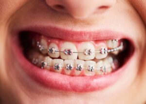 orthodontics